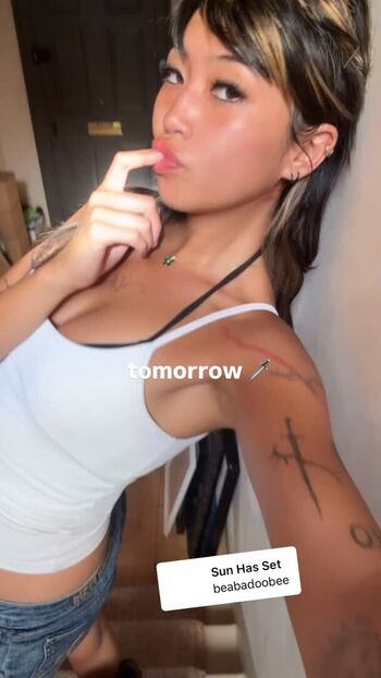 Radvxz