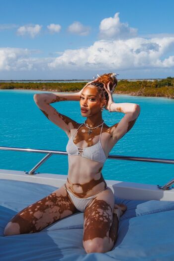 Winnie Harlow